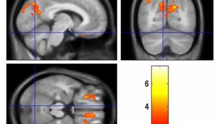 Brain-Hacking May Cure Tourettes — Or Weaponize It